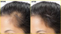 Huile de croissance de cheveux, sérum favorisant la poussée des cheveux, produit 100% naturel, livraison directe