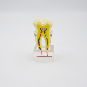 Modelo Dental Multifuncional de 6 Molares con Nervio Anatómico para Demostración Educativa para Dentistas, Producto Multifuncional para la Higiene Bucal - Product Image 3