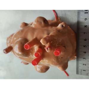 Módulo de modelo de entrenamiento de miomectomía de tumor de endoscopia quirúrgica KyrenMed para práctica - Product Image 2