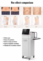 Appareil de massage anticellulite à rouleaux internes Cellusphere pour amincissement
