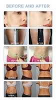 Meilleure machine professionnelle de remodelage corporel non invasive, cryothérapie, machine de cryolipolyse au laser