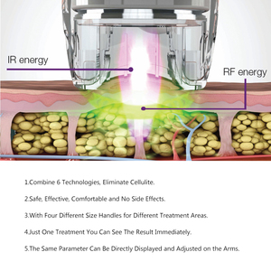 Máquina Profesional de Adelgazamiento Corporal Winkonlaser 6 <span class=keywords><strong>en</strong></span> 1 con Vacumterapia y Radiofrecuencia para Eliminar la Celulitis y Moldear la Figura - Product Image 4