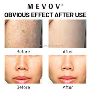 Crème <span class=keywords><strong>pour</strong></span> <span class=keywords><strong>le</strong></span> <span class=keywords><strong>visage</strong></span> à base de plantes professionnelle OEM Correcteur des taches foncées et Gel dissolvant des <span class=keywords><strong>boutons</strong></span> Gel blanchissant <span class=keywords><strong>pour</strong></span> la peau - Product Image 5