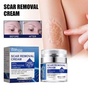 <span class=keywords><strong>Crema</strong></span> Reparadora de Cicatrices EELHOE, Hidratante y Suavizante de la Piel con <span class=keywords><strong>Aloe</strong></span> <span class=keywords><strong>Vera</strong></span>, Desvanece Cicatrices de <span class=keywords><strong>Embarazo</strong></span> y Quirúrgicas, Antiarrugas para el Cuerpo de la Mujer - Product Image 6