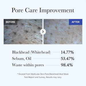 Medicube for Zero Pore, Bálsamo Rosa para Puntos Negros y Acné con Cepillo, <span class=keywords><strong>Crema</strong></span> Facial de Día con <span class=keywords><strong>C</strong></span>úrcuma, Antienvejecimiento y Colágeno - Product Image 4