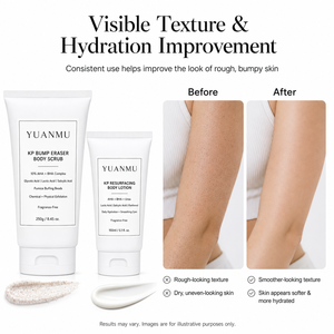 Ensemble <span class=keywords><strong>Lotion</strong></span> et Gommage Corporel Lissant KP Bump Smoothing – Acides AHA <span class=keywords><strong>BHA</strong></span> Glycolique Lactique, Pierre Ponce, Urée – Soin Peau Rugueuse et Bosselée - Product Image 5