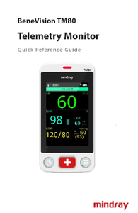 Mindray TM80 Vet Handheld Veterinary Patient Monitor with 3.5" Touch <b>Screen</b> IPX7 Waterproof Wireless Telemetry for Animal Clinic - Product Image 5