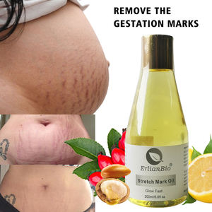 Kualitas tinggi stretch mark minyak esensial persentase ekstrak alami mengurangi bekas luka kerutan penghilang tanda kerutan minyak - Product Image 2