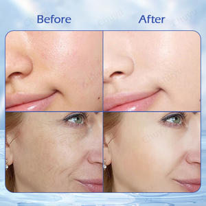 用于面部和身体的皮肤维生素血清，5合<span class=keywords><strong>1</strong></span>抗皱紧致血清，透明质酸抗衰老精华，胶原蛋白 - Product Image 2