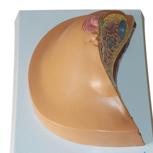 نموذج سرطان الثدي الأنثوي بالحجم الطبيعي نموذج فحص الثدي المرضي للإناث نماذج تشريحية للتعليم الطبي - Product Image 4