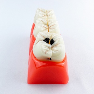 FUREIN SMILE Modelo Dental Patológico Desmontable 4 en 1, Anatomía del Diente con Caries, Educación Dental, Higiene Bucal Multiusos, PVC - Product Image 3