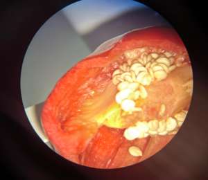 ליבה אופטית קולפוסקופ n 2200bi אבחון רפואי נייד קולפוסקופיו נייד ג 'ינאקולוגי לבדיקת הנרתיק - Product Image 4