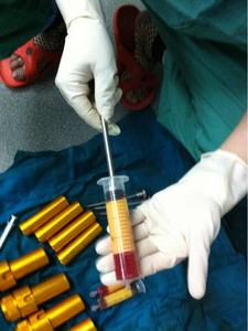 ספסל במהירות נמוכה שולחן שומן Svf Tcm תאי גזע 60cc 50cc צנטריפוגה מזרק - Product Image 6