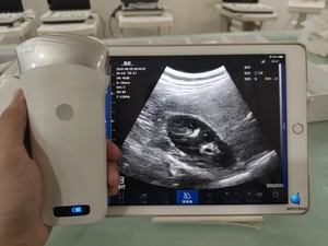 BESTRAN für Schweine Tragbarer Medizinischer Kabelloser Ultraschall-Konvexsonde mit Eingebauter Batterie aus Kunststoff 1 Jahr Garantie BT-UD82 - Product Image 3