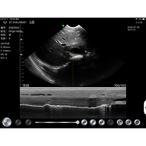 <span class=keywords><strong>Sonde</strong></span> d'échographie sans fil micro-convexe, mode B, appareil d'échographie <span class=keywords><strong>portable</strong></span>, compatible Android, iOS, Windows, BW15 - Product Image 6