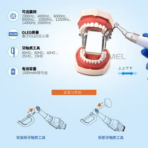 Kit de pulidor dental eléctrico Vimel Ortho Prophy X con accesorios de pulido para limpieza dental y suavizado del esmalte - Product Image 3