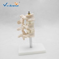 Modelo Anatómico Comparativo de Patología de Columna Vertebral, Modelo de Lesión de Vértebras Lumbares para Enseñanza de Ortopedia, CE/ISO/ROHS/CNAS