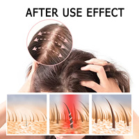 30 jours efficace naturel 5% vitamines huile sérum avec Derma Roller Kit stimuler la croissance des cheveux traitements anti-chute de cheveux pour les femmes
