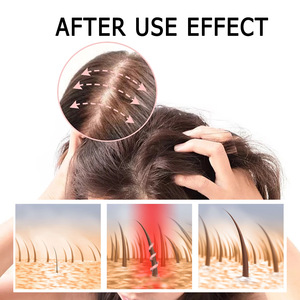 30 jours efficace naturel 5% vitamines huile sérum avec Derma Roller Kit stimuler la croissance des <span class=keywords><strong>cheveux</strong></span> traitements anti-chute de <span class=keywords><strong>cheveux</strong></span> pour les femmes - Product Image 2