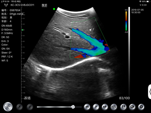 192 Elements Vascular Doppler Wireless <strong>Convex</strong> <strong>Ultrasound</strong> <strong>Probe</strong> - Product Image 6
