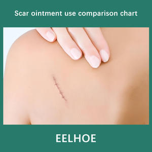 Crema para el Cuidado de la Piel de 30 ml, Portátil, de Bajo <span class=keywords><strong>Precio</strong></span>, Crema para Cicatrices, Crema para una Piel Suave, Éxito de Ventas al por Mayor - Product Image 5