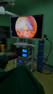 Shreek endoscopia médica ginecologia histeroscópio 4k endoscópio câmera sistema torre laparoscópica - Product Image 6