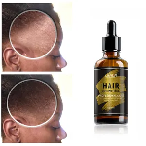 chinese anti itch regrowth hair oil with logo,argan growth oil for african hair