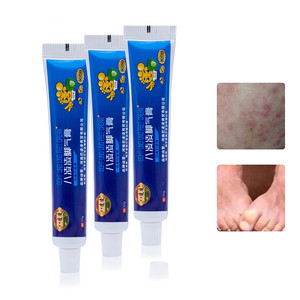 Бесплатная доставка, крем для удаления грибковых инфекций, средство для лечения болей в ногах, мазь для пилинга берибериса - Product Image 3
