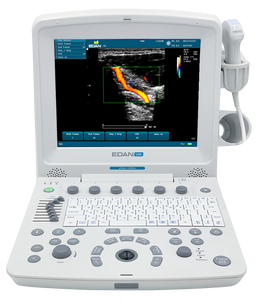 Appareil d'échographie Doppler couleur portable Edan U50, instruments d'échographie médicale pour le diagnostic clinique humain - Product Image 6