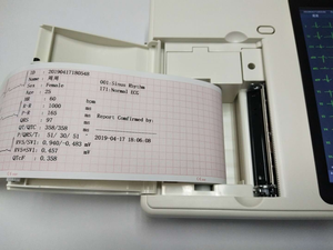 Elektrokardiogramm Veterinärinstrument 3-Kanal-EKG-Gerät Preis für Tiere - Product Image 6