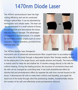 The Latest Upgraded Model ABS Material High-efficiency Laser Cutter with Three Different Wavelengths - Product Image 6