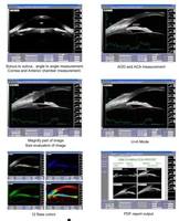 Échographe ophtalmique UBM (A/B/P/UBM) à échelle complète, scanner oculaire, équipement d'ophtalmologie SW-3200S