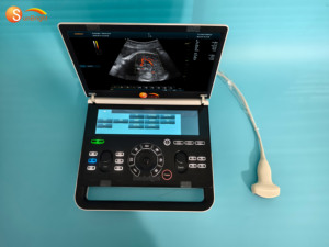 Échographe Doppler couleur portable de qualité médicale avec fonctions 3D, 4D, échographie et USG - Product Image 4