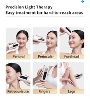 Appareil de beauté cutanée à lumière excimère rechargeable, portable et compact, pour le traitement du vitiligo