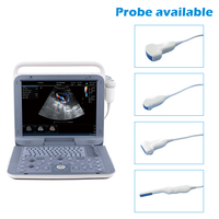 Ecógrafo Doppler Color Portátil con Pantalla LCD de 15 Pulgadas, 5 Modos de Imagen, 8 Sondas, 500GB DICOM, para Abdomen, Cardiaco, Obstetricia/Ginecología y Clínica