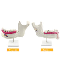 Dientes de plástico para dentición y artes marciales mixtas, modelo anatomico para dentición y artes marciales mixtas, instrumento de enseñanza científica - Product Image 3