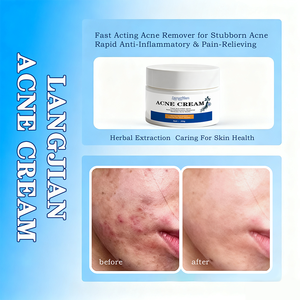 Crème de traitement de l'acné à base de plantes avec ginseng, lavande et menthe poivrée, réduit <span class=keywords><strong>les</strong></span> <span class=keywords><strong>rougeurs</strong></span> et l'inflammation, renforce la barrière cutanée, atténue <span class=keywords><strong>les</strong></span> marques d'acné - Product Image 3