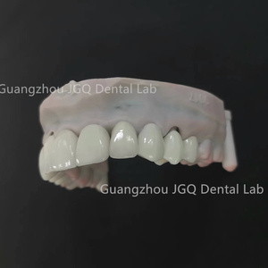 Buen <span class=keywords><strong>Precio</strong></span> Chapa Dientes Restauración <span class=keywords><strong>de</strong></span> porcelana Blanqueamiento dental Preparación mínima Carillas <span class=keywords><strong>dentales</strong></span> - Product Image 4