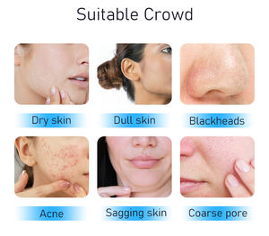 Pantalla visual hidro microdermoabrasión microcorriente <span class=keywords><strong>facial</strong></span> H2O2 cuidado de la piel Aqua Peel Hydra máquina de dermoabrasión - Product Image 5