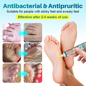 Ungüento KanyeHB para el Cuidado del Olor de Pies, Crema para el Cuidado de la Salud de la Piel de los Pies, para la Dermatofitosis y la Neuritis Dietética - Product Image 4