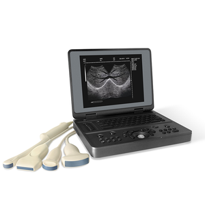 Dispositivo portátil médico do ultrassom de alta definição de Doppler, varredor de capacidade elevada do ultrassom do corpo humano do Portátil-tipo - Product Image 1