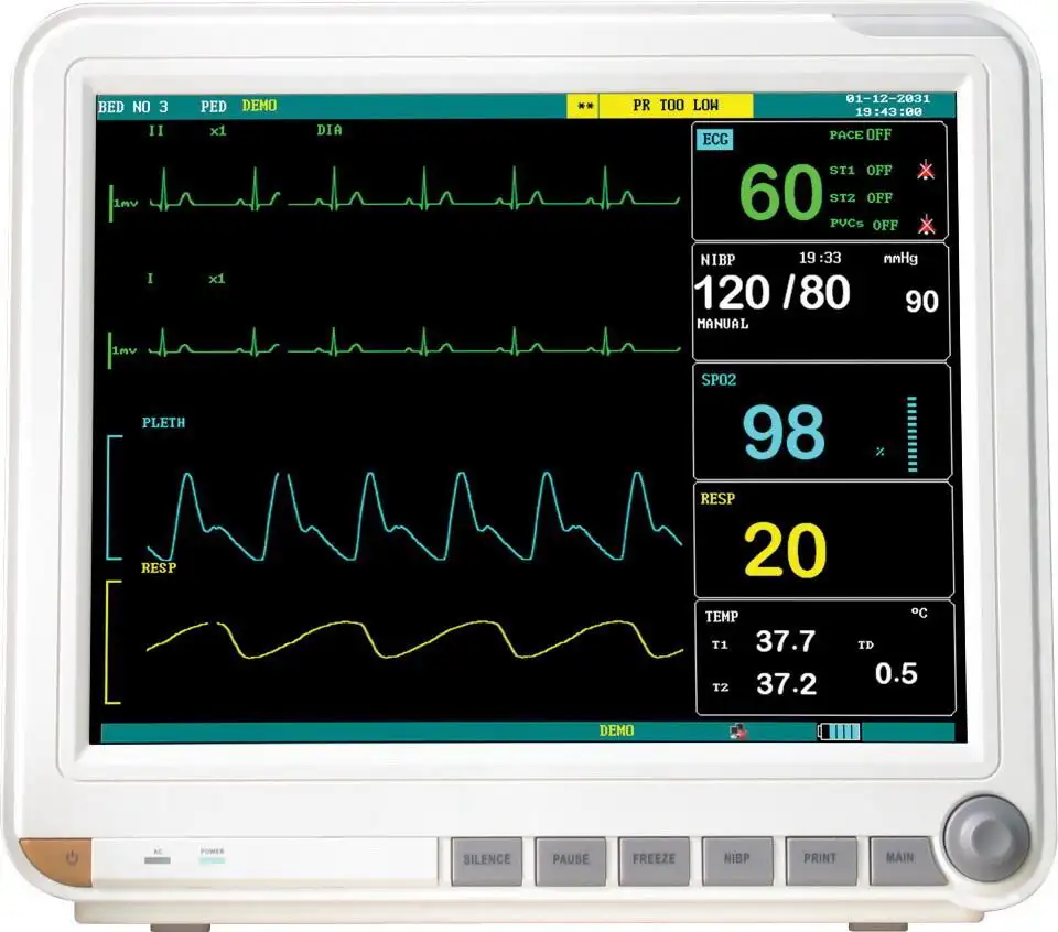 15.1inch Laptop Color Doppler Ultrasound Scanner Vascular Pet Multi-parameter Patients Monitors Veterinary