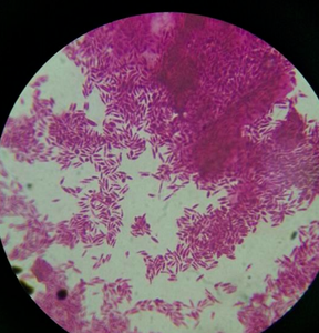 Paecilomyces Lilacinus, Nematodo Natural Enemigo de las Láridas, Parasita Huevos, Larvas y Nematodos Femeninos - Product Image 3
