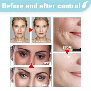 Crème au collagène Jaysuing 30g, meilleure crème <span class=keywords><strong>anti</strong></span>-âge pour le visage, crème hydratante personnalisée, éclaircissante, apaisante pour les démangeaisons, crème pour le visage pour femmes - Product Image 4