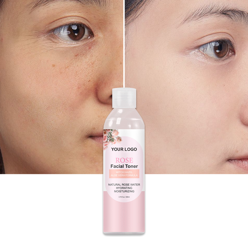 OEM ODM Milk Toner Wet Compress