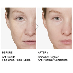 プライベートラベルスキンケアカプセルビタミンCビタミン<span class=keywords><strong>E</strong></span>パールパウダーフェイスセラムカプセルアンチエイジング用 - Product Image 4