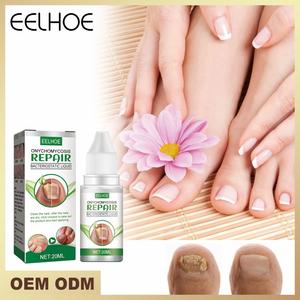 EELHOEWholesale 20ml Traitement et Réparation <span class=keywords><strong>des</strong></span> Mycoses <span class=keywords><strong>des</strong></span> <span class=keywords><strong>Ongles</strong></span> <span class=keywords><strong>des</strong></span> Pieds, Soin Anti-Fongique, Élimination <span class=keywords><strong>des</strong></span> Mycoses, Outils et Fournitures pour <span class=keywords><strong>Ongles</strong></span> Pedivac - Product Image 2