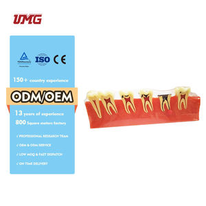 Gesectioneerd Met Pulpziekte Aandoeningen Parodontale Ziekten Classificatiemodel - Product Image 1