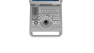 New SONOSCAPE y tế siêu âm chẩn đoán hình ảnh hệ thống siêu âm cụ B/W hiển thị máy siêu âm - Product Image 3