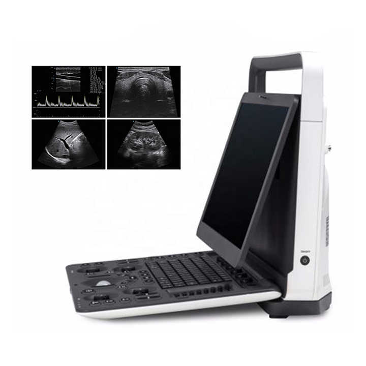Medsinglong Medical Ultrasound Instrument MSK OB/GYN 3D 4D 5D Ultrasound Scanner Sonoscape E2 Portable Ultrasound Machine
